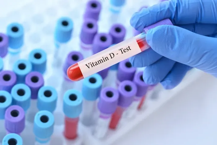vitamin d test